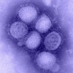 H1N1_flu
