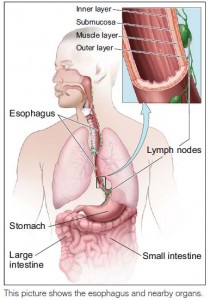 esophagus1
