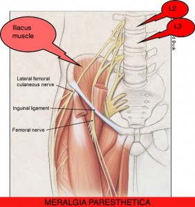 Meralgia-Paresthetica-Lateral-Femoral-Cutaneous-Nerve