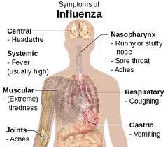 influenza