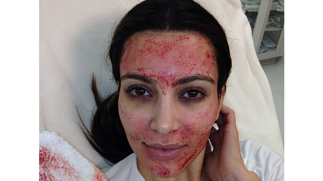 Kim Kardashian facial Celebuzz