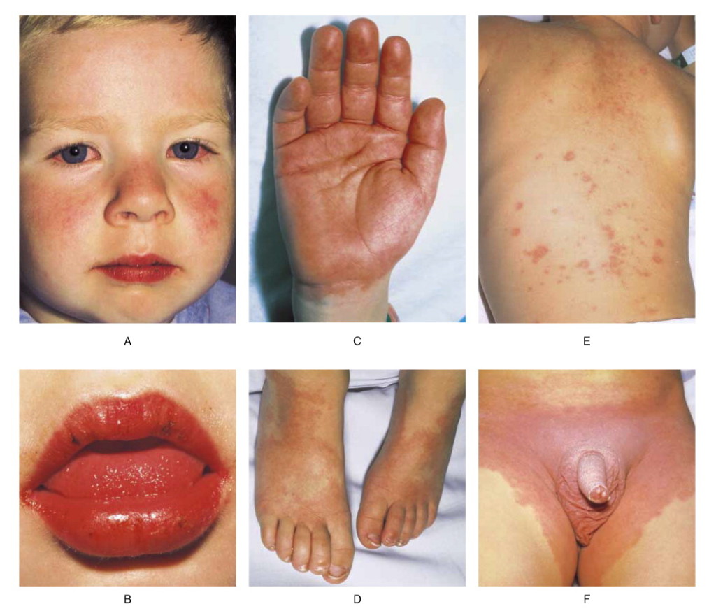 Photo Credit: NEJM