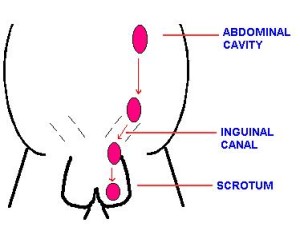 testes descent
