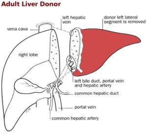 live liver donor