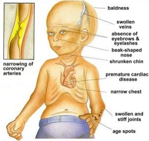 progeria_diagram(1)