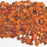 gallstones bilirubin
