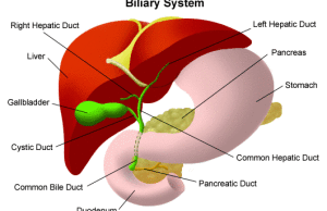 Biliary_Duct_Cancer-3