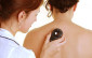 cancer_screening_sunscreen_bands_facts_on_melanoma
