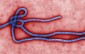 2048px-ebola_virus_virion